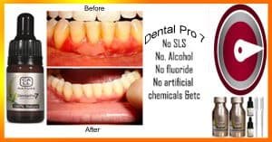 Reverse Receding Gums Naturally