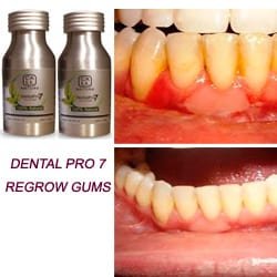 Healthy Gums Vs Unhealthy Gums