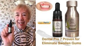 Natural Remedies For Receding Gums
